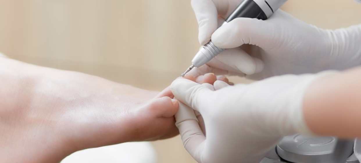 Diabetes Nail Care: Essential Tips for Healthy, Safe Nails